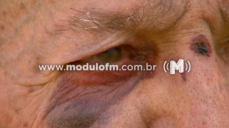 Idoso com problema de locomoção é agredido por síndico de condomínio na represa de Nova Ponte