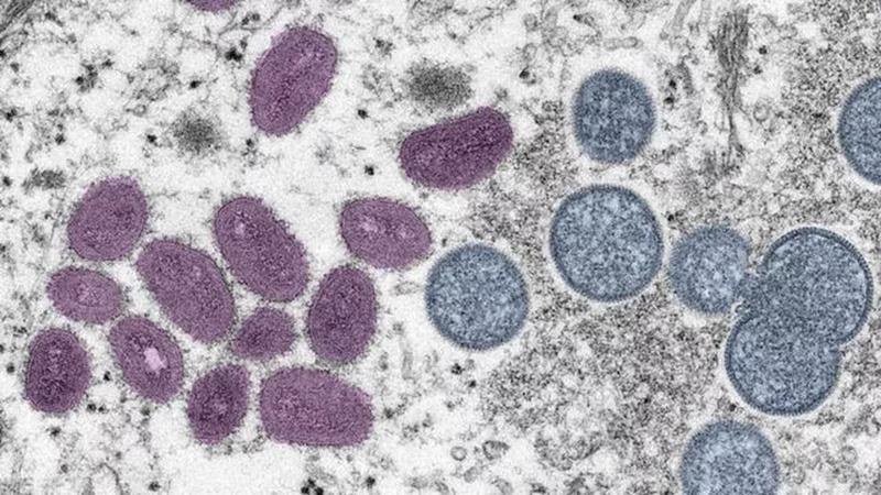 Calendário de vacinação contra Monkeypox deve sair nesta semana